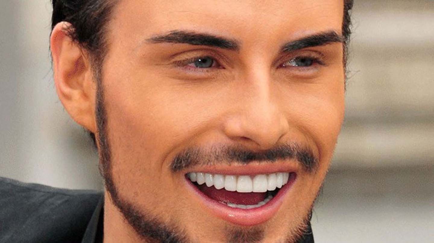 Rylan Teeth Antalya