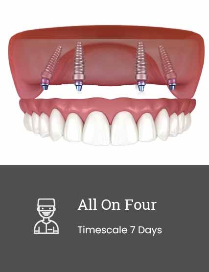 All on 4 Dental Implants