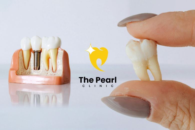 Modern Solution for Tooth Loss!