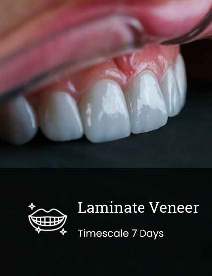 Laminate Veneer