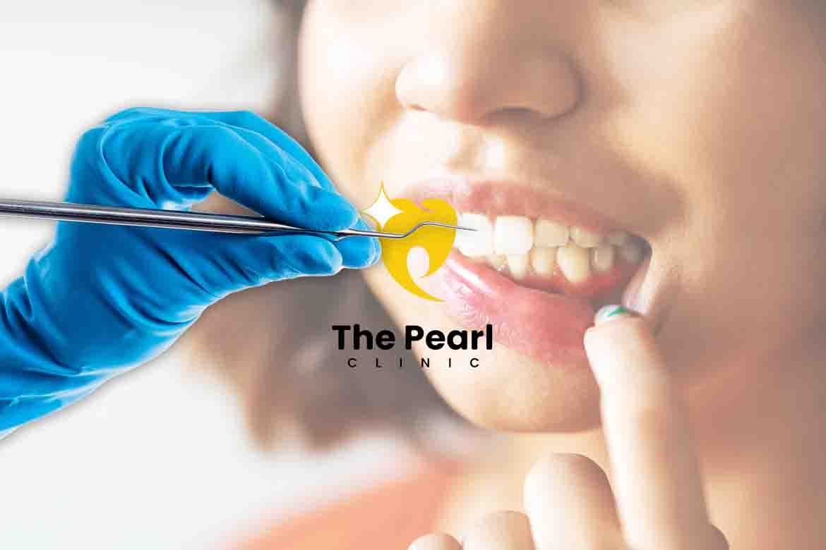 Protect Your Smile!