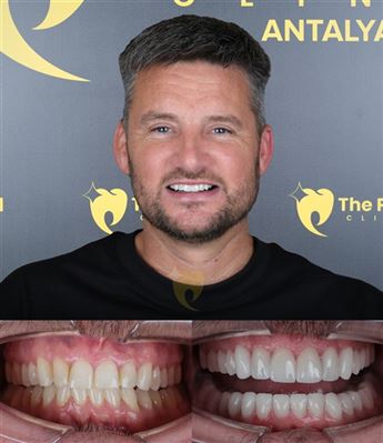 🎈Outstanding result