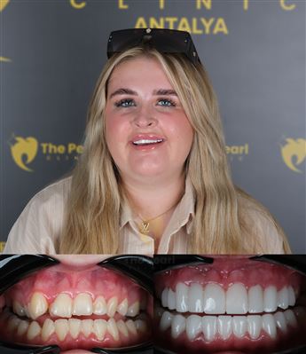 💎✨ Join us at Pearl Clinic for a healthy and beautiful smile.