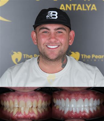 This smile serves as a beautiful reminder of feeling good and savoring life.